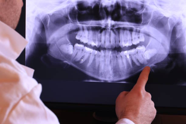 Best Emergency Tooth Extraction in Salem, MA